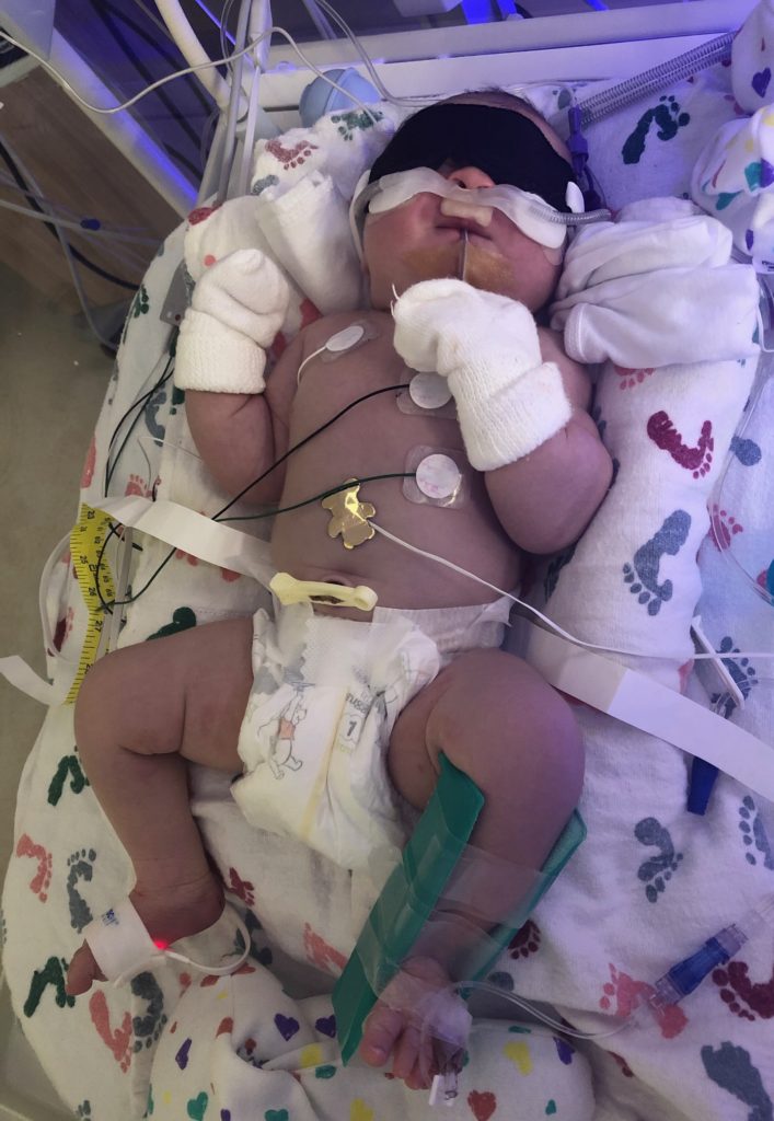 baby in NICU at Jupiter Medical Center