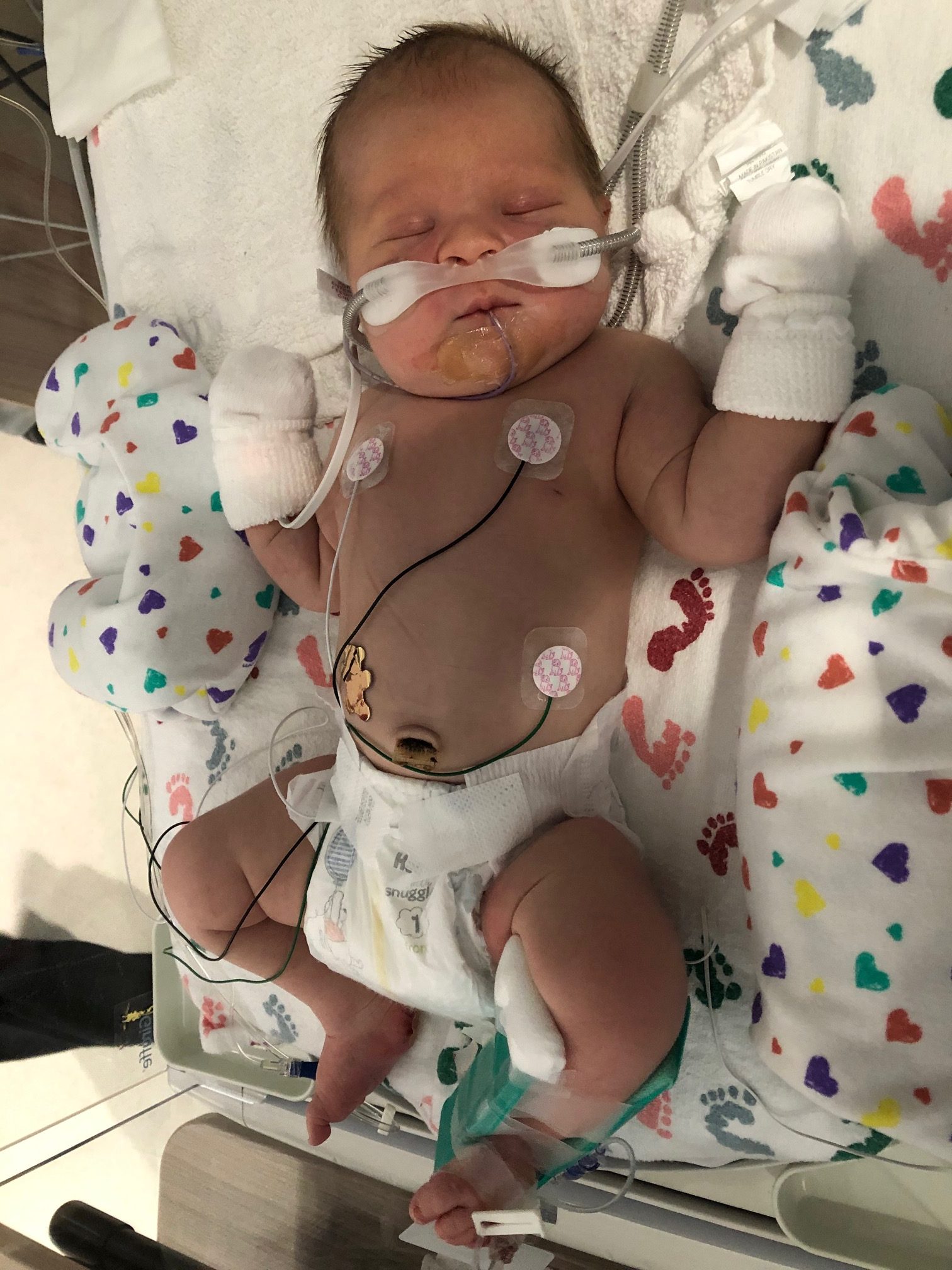 Our NICU Journey - Melanie Stanton
